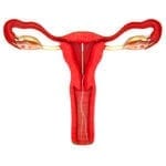 IUD is an abortifacient