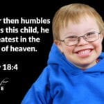 born with Down Syndrome